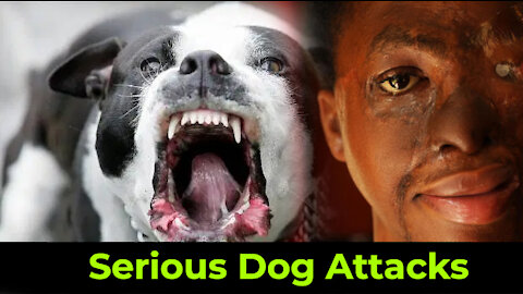 Dogs Attacks Caught On Camera