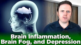 Brain Inflammation, Brain Fog, and Depression | Dr. J Q & A