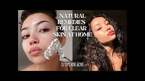 Clear Skin Secrets: 15 Tips & Tricks for Acne Without Breaking the Bank