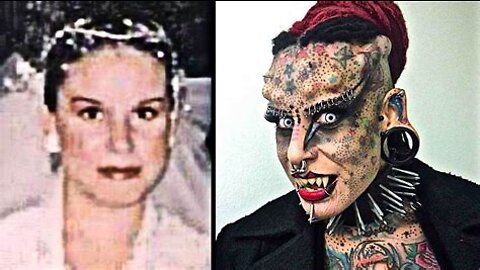 People Who Took Plastic Surgery Too Far