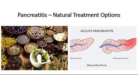 Pancreatitis - Natural Treatment Options
