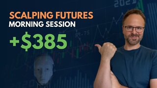 WATCH ME TRADE | TRADER VS SYSTEM Round 3 | DAY TRADING Nasdaq Futures Trading Scalping Day Trading
