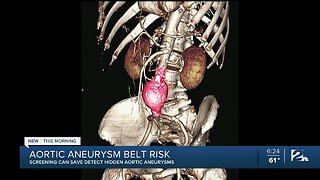 Aortic Aneurysm Belt Risk: Screening Can Save Detect Hidden Aortic Aneurysms