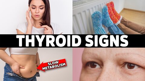 7 Early Warning Signs Your THYROID is in Trouble (Hypothyroidism)