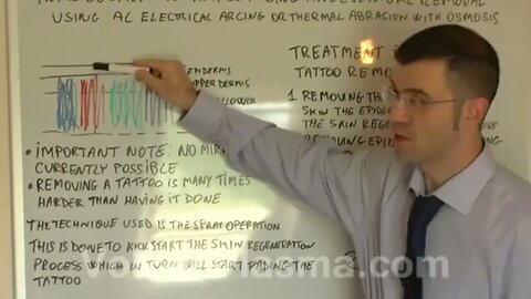 THE RADIOFRECUENCY DEVICE EXPLANATION