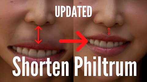 Shorten Philtrum By Activating Philtrum Exercise