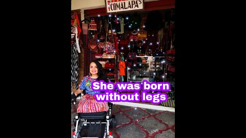 She was born without legs #dak_ampute