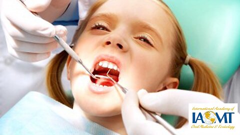 "Silver" Fillings Have Mercury and Harm Children