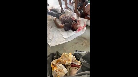 عدد من الشهداء والإصابات في صفوف المواطنين بعد غارات عنيفة شنتها طائرات الاحتلال على مواصي خان يونس