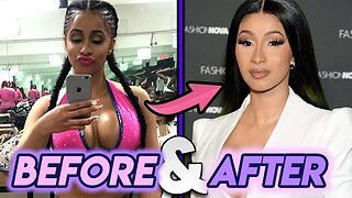 Cardi B | Before and After | Plastic Surgery Transformation