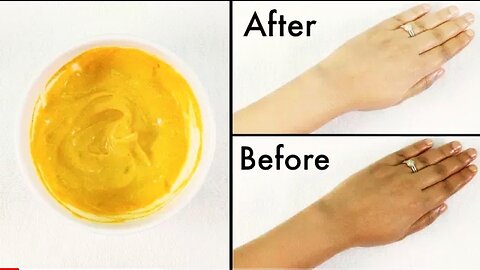 How To Remove Tan From Face, Neck, Hands, Knees Overnight| Simple home remedie