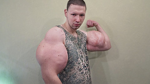 Russian ‘Hulk’ Injects Dangerous Chemicals To Look BIGGER | HOOKED ON THE LOOK