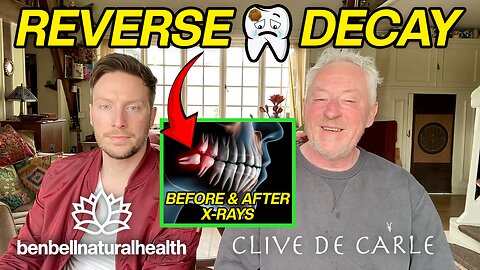 Clive de Carle with Ben Bell Natural Health | Reverse Tooth Decay (Before & After X-Rays)