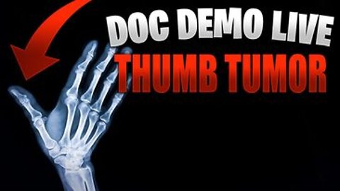Doc Demo Live - Thumb Tumor - Reverse The Irreversible