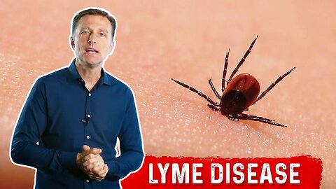 7 Weird Lyme Disease Symptoms that You Need to Know – Dr.Berg