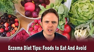 Eczema Diet Tips: Foods to Eat And Avoid