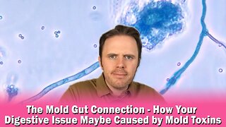 The Mold Gut Connection - How Your Digestive Issue Maybe Caused by Mold Toxins | Podcast #371