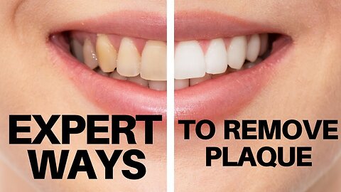 how to remove plaque from teeth | best ways to remove plaque