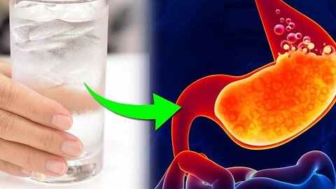 HOW TO TREAT ACID REFLUX NATURALLY IN 1 MIN - HEARTBURN RELIEF INSTANTLY