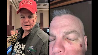 Ex-NYPD cop punched at his own birthday party after red cap mistaken for MAGA hat