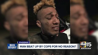 Valley man says he was beat up by police for no reason