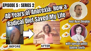 40 Years of Anorexia: How a Radical Diet Saved My Life With Valerie Smith