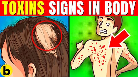 12 Warning Signs Too Many Toxins In Your Body