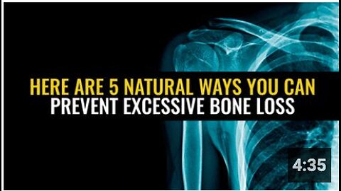 Here are 5 natural ways you can prevent excessive bone loss