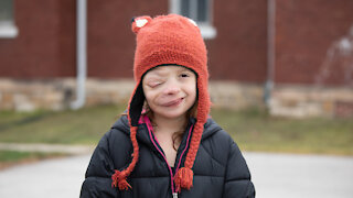 Brave 10-Year-Old Battles Rare Facial Tumour | BORN DIFFERENT