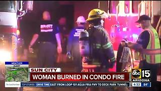 Woman burned in Sun City fire