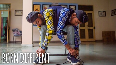 We're 19 And Conjoined Twins - But Happy To Be Together | BORN DIFFERENT