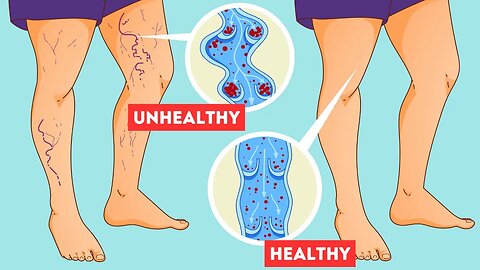 Lack of These Vitamins Can Be The Cause of Your Poor Blood Circulation
