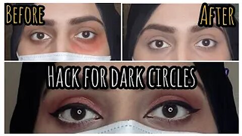 Hack for hiding dark circles using lipstick || best way to hide dark circles without concealer ||