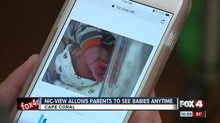 Nic-View Allolws Parents to See Babies Anytime