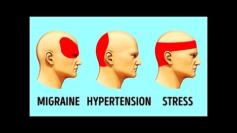 HOW TO GET RID OF A HEADACHE IN 5 MINUTES