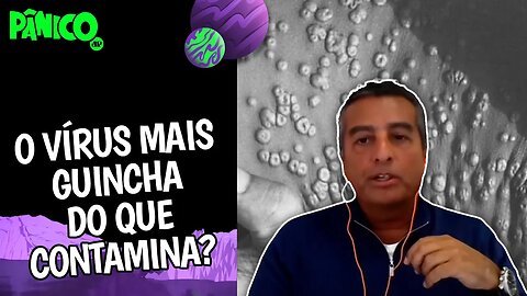 Dr. Zeballos: 'VARÍOLA DO MACACO NÃO É FATAL E NEM DEVE GERAR MEDO NAS PESSOAS'