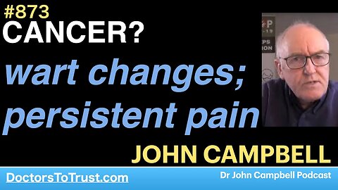 JOHN CAMPBELL 4 | CANCER? wart changes; persistent pain