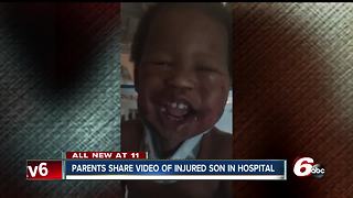 Indy toddler recovering after being severely injured at daycare