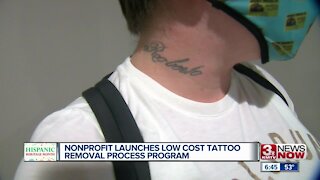 Nonprofit launches low cost tattoo removal process program