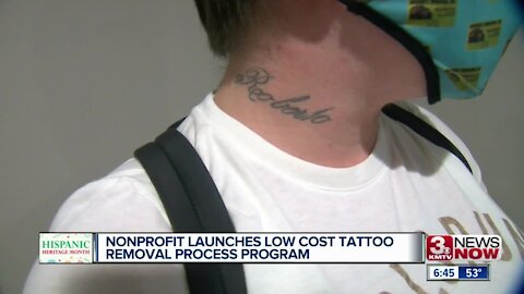 Nonprofit launches low cost tattoo removal process program