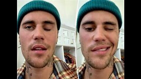 Justin Bieber Com Paralisia FACIAL, E A Esposa Com Coagulo no Cerebro