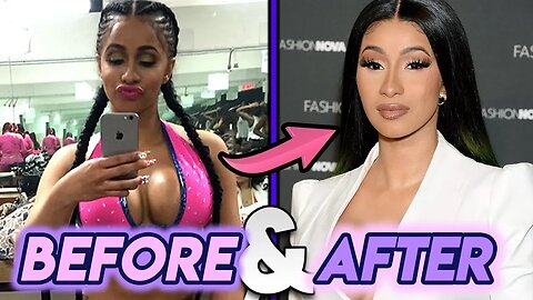 Cardi B | Before and After | Plastic Surgery Transformation