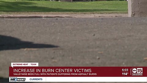 Arizonans getting burned on pavement amid scorching temperatures