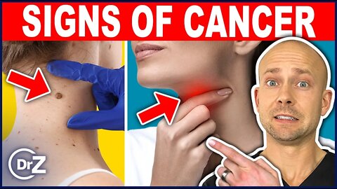 10 Warning Signs Of Cancer You MUST Know About