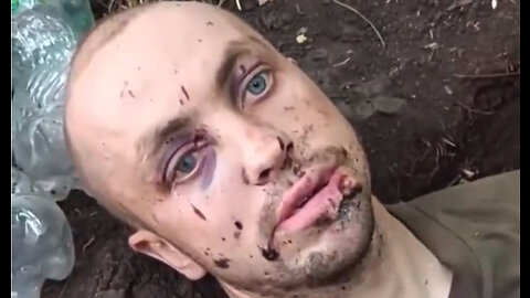 Russians capture Abandoned Ukrainian Soldier who says he's a Civilian who was Forced to Fight 🪖🤕