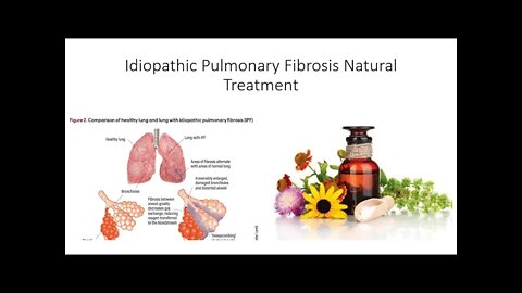 Idiopathic Pulmonary Fibrosis Natural Treatment