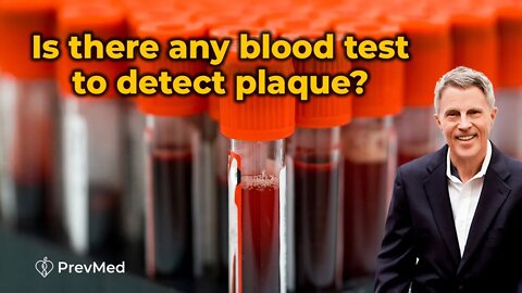Is there any Blood Test to Detect Plaque?