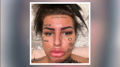 Trolls Mock My Face Tattoos - How Will I Look Without Them? I TRANSFORMED