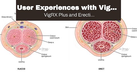 User Experiences with VigRX Plus vs Erectin: Which One Delivers Results? Fundamentals Explained...
