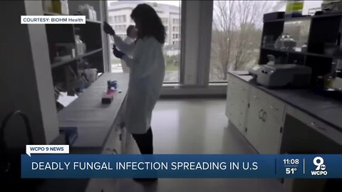 Potentially deadly fungus spreading in the US